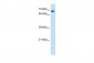 TAF6 antibody - N-terminal region